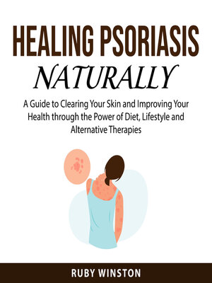 cover image of Healing Psoriasis Naturally